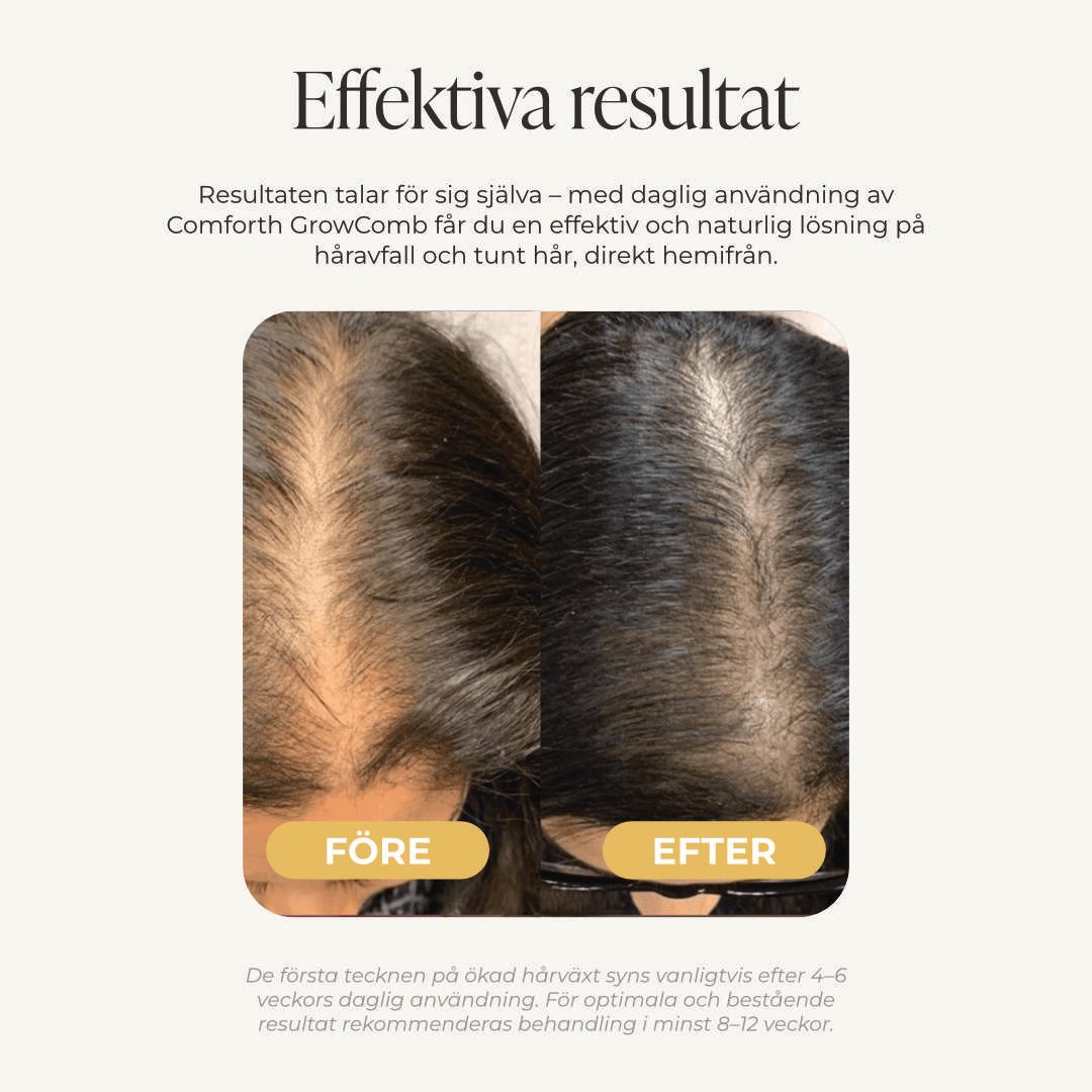 Comforth GrowComb - LED-hårtillväxtkam
