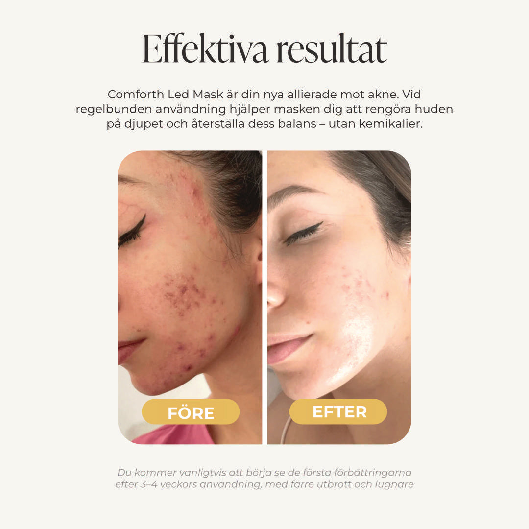 Comforth Light Pro - LED Mask